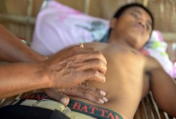 كيف تقي نفسك من الإصابة بسرطان الأمعاء؟