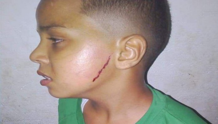 مليشيات الانقلاب تعذب طفلًا شرقاويًا للكشف عن مكان والده