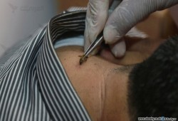 العلاج بلسعات النحل... طب بديل في غزة