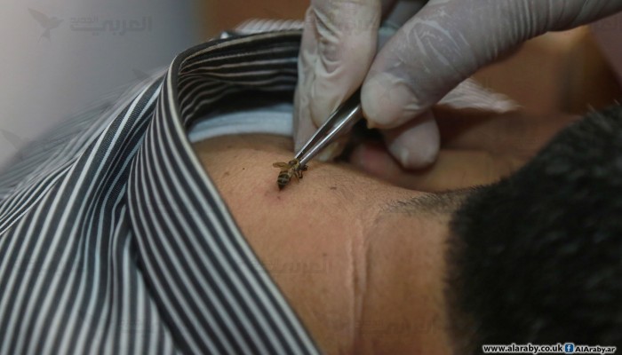 العلاج بلسعات النحل... طب بديل في غزة