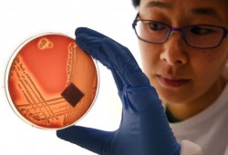 ما هي أبرز المشاكل الصحية التي تنتقل عبر الوراثة؟