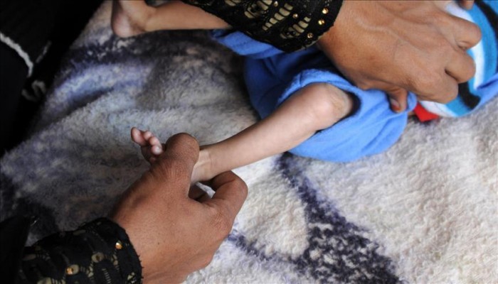 الأمم المتحدة تحذّر: مجاعة واسعة توشك أن تصبح واقعًا في اليمن