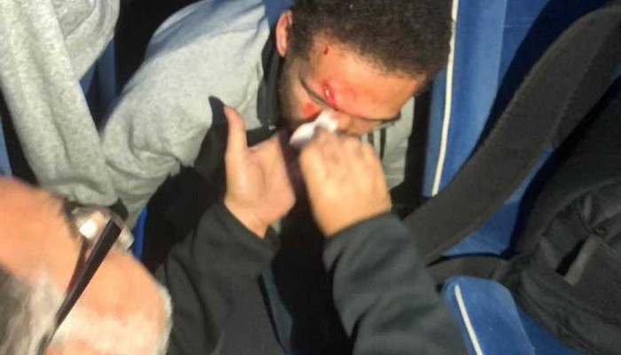 إصابة لاعب الأهلي بعد اعتداء جماهير الترجي على حافلة الفريق