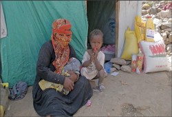 نازحو اليمن.. مأساة إنسانية تخففها لمسات تركية (تقرير)