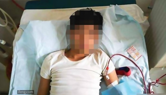 باع كليته لشراء آيباد وآيفون.. شاب صيني يصاب بإعاقة