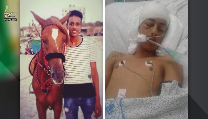 استشهاد طفل متأثرًا بإصابته في مسيرة العودة شرق البريج