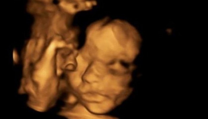 عملية جراحية نادرة ببريطانيا لجنين ثم إعادته إلى الرحم