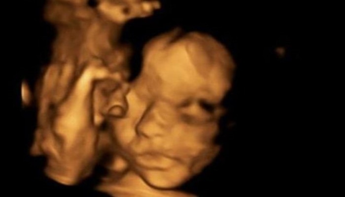 عملية جراحية نادرة ببريطانيا لجنين ثم إعادته إلى الرحم
