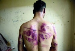 "رايتس ووتش" تطالب بفتح تحقيق بجرائم التعذيب بمصر