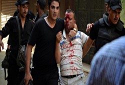 “العفو الدولية” تتهم أمريكا وفرنسا بتصدير أسلحة لـ”السيسي” لقمع المظاهرات السلمية