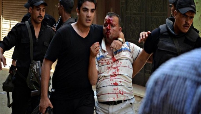 “العفو الدولية” تتهم أمريكا وفرنسا بتصدير أسلحة لـ”السيسي” لقمع المظاهرات السلمية