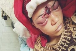 بدولة العسكر.. محامية سألت عن إذن النيابة فكسر الضابط جمجمتها