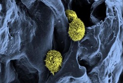 الخلايا الجذعية تعالج طفلًا عمره سنتان مصابًا بمرض نادر بالدم