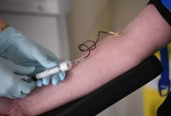 باحثون: أصحاب فصيلة الدم هذه أكثر عرضة للإصابة بـ"كورونا"