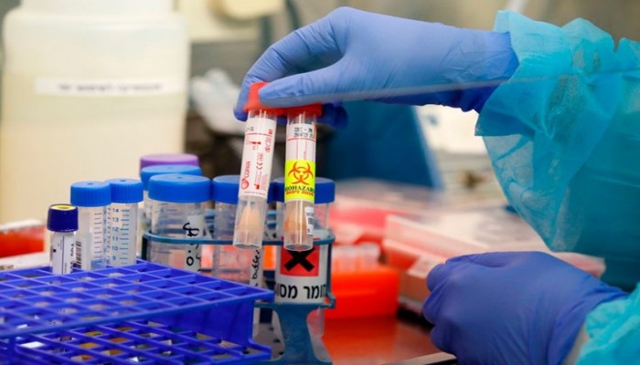 جائحة كورونا ستنتهي بهذه الطريقة فقط.. لكن متى وكيف؟