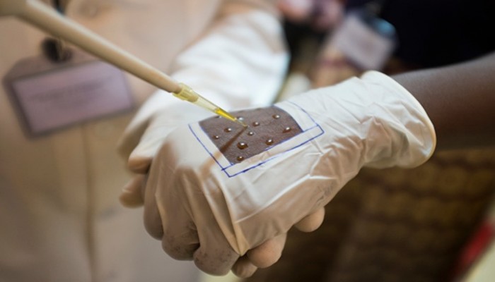 ثبوت فشل لقاح الملاريا علميا لعلاج مصابي "كورونا"