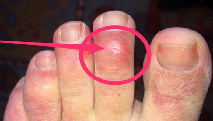 أعراض جديدة بالجسم قد تدل على الإصابه بفيروس كورونا