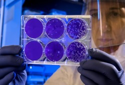 دراسة: النسخة الراهنة لفيروس كورونا معدية أكثر من السابق