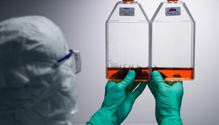 هل ستكون عقاقير "ستيرويد" علاجاً فعالاً لمصابي كورونا؟