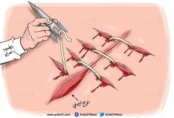 اليمن .. والطبيب العربي