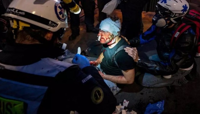 تنديد حقوقي باعتداء الشرطة الفرنسية على مصور سوري