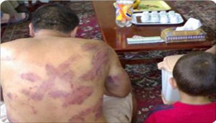 كادت أن تضاهي محاكم التفتيش: شهادات حية من أقبية تحقيق أمن عباس (صور توضيحية)