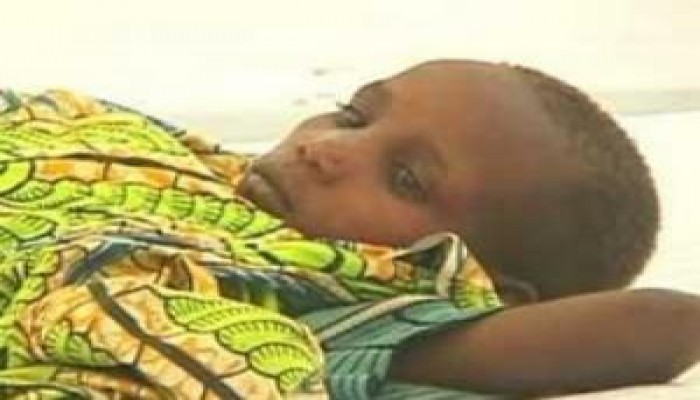 ارتفاع عدد وفيات مرض الكوليرا في زيمبابوي