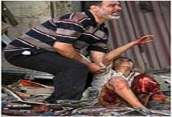 موقع للمجزرة الصهيونية بعدة لغات عالمية