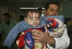 استهتاراً بالعالم الدولى أو وقاحةً.. إسرائيل تعترف بقصف غزه بالقنابل الفوسفوريه