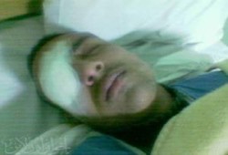 بدء محاكمة أمين شرطة فقأ عين طالب إخواني بالبحيرة