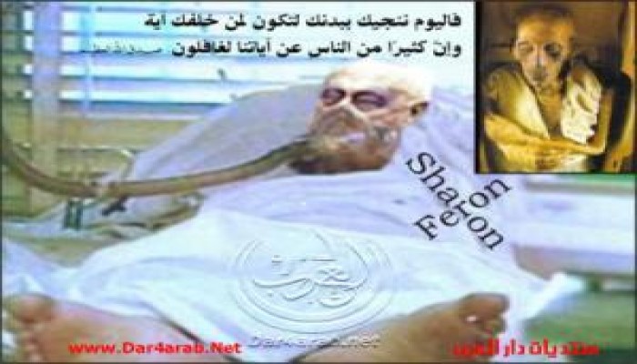 المستشفى الذى يرقد فيه شارون يرغب فى نقله لمنزله