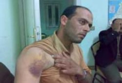 مصريون ضد التعذيب تكشف عن حالات تعذيب وصعق بالكهرباء داخل مقرات أمن الدولة