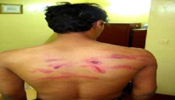 أوباما فى مصر لدعم الحريات أم لدعم النظام ؟؟