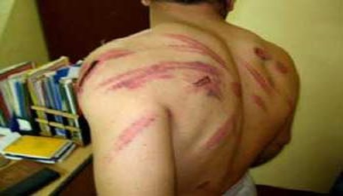 بعد تعذيب مختطفي المحلة لمدة شهرين "سواسية" يطالب النظام بوقف التعذيب في مقارِّ أمن الدولة