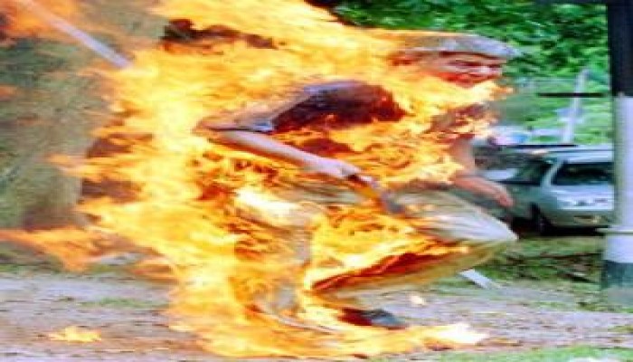 الفقر يدفع عجوزا في صعيد مصر لاشعال النار في نفسه