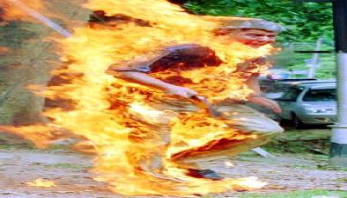 الفقر يدفع عجوزا في صعيد مصر لاشعال النار في نفسه