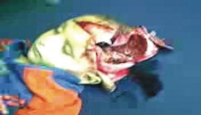 والدتا شهيدتين فلسطينيتين تتحدثان عن سرقة الاحتلال أعضاء ابنتيهما (تقرير)