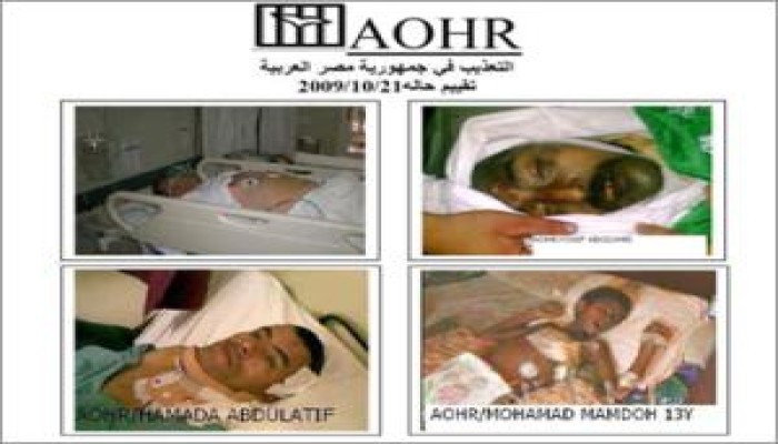 التعذيب بمصر فاق الحدود ولايطاق وأصبح ممنهجاً