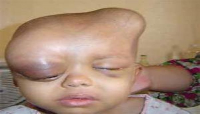 لا للإنجاب.. القرار المر لنساء الفلوجة!