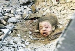 مشاهد دامية  تفضح الحرب وتهتك ستر الشركاء فيها