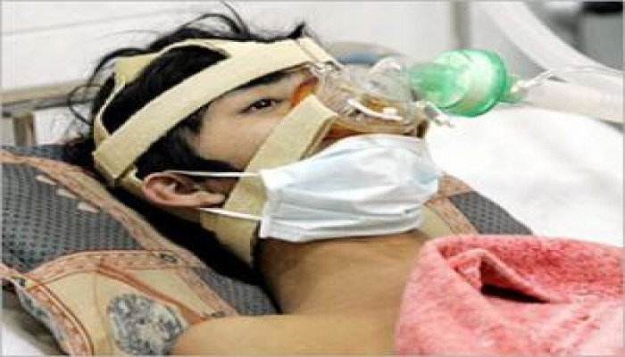 3 حالات وفاة "بالخنازير" ترفع العدد إلى 182 حالة وقاة