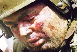 خلال 24 ساعة .. إصابة أربعة مغتصبين في مناطق مختلفة بالضفة المحتلة