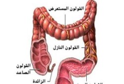 سرطان القولون خطر جديد يهدد المصريين