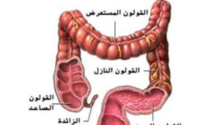 سرطان القولون خطر جديد يهدد المصريين