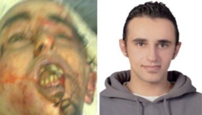 هيومن رايتس ووتش: يجب على مصر أن تحاكم من تسبب في مقتل (شهيد الطوارئ)