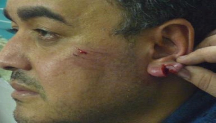 الاعتداء الوحشي على أنصار المهندس سعد الحسيني أثناء الفرز (فيديو)