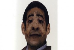 الداخلية تنشر صورة لجثة مرممة قالت أنها ربما تكون لإنتحاري الأسكندرية