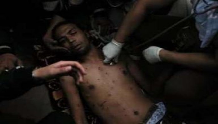 وزير الصحة: 365 حالة وفاة و5500 مصاب منذ بداية ثورة مصر