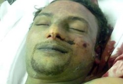 مطالبات بدفن شهيد مجهول قُتل في المظاهرات وهو يبتسم بميدان التحرير