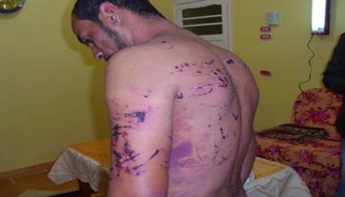 أمن الدولة (القذر) كان حاضراً فى ميدان التحرير وقام بتعذيب وتعرية شباب وفتيات !!
